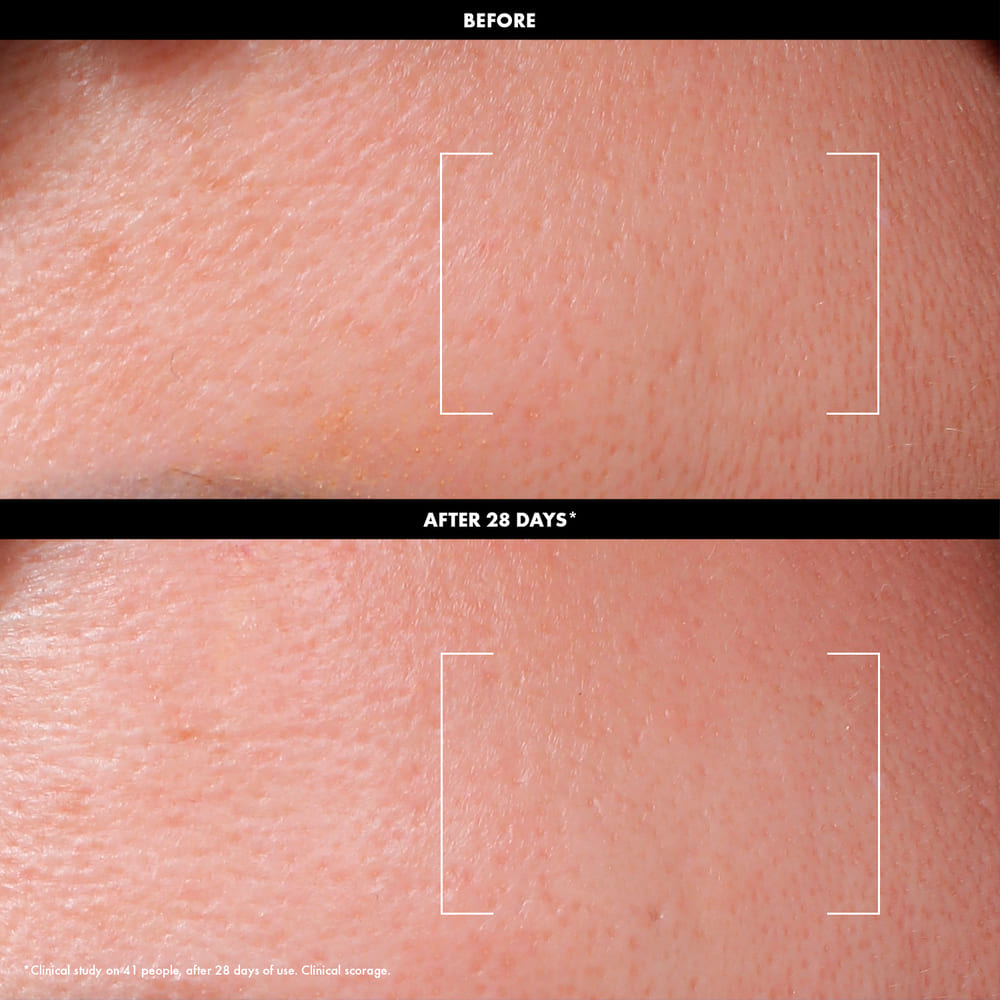 DAILY RESURFACING TONER (T&Oacute;NICO EXFOLIANTE CON 3% AHA + 2% VITAMINA C)